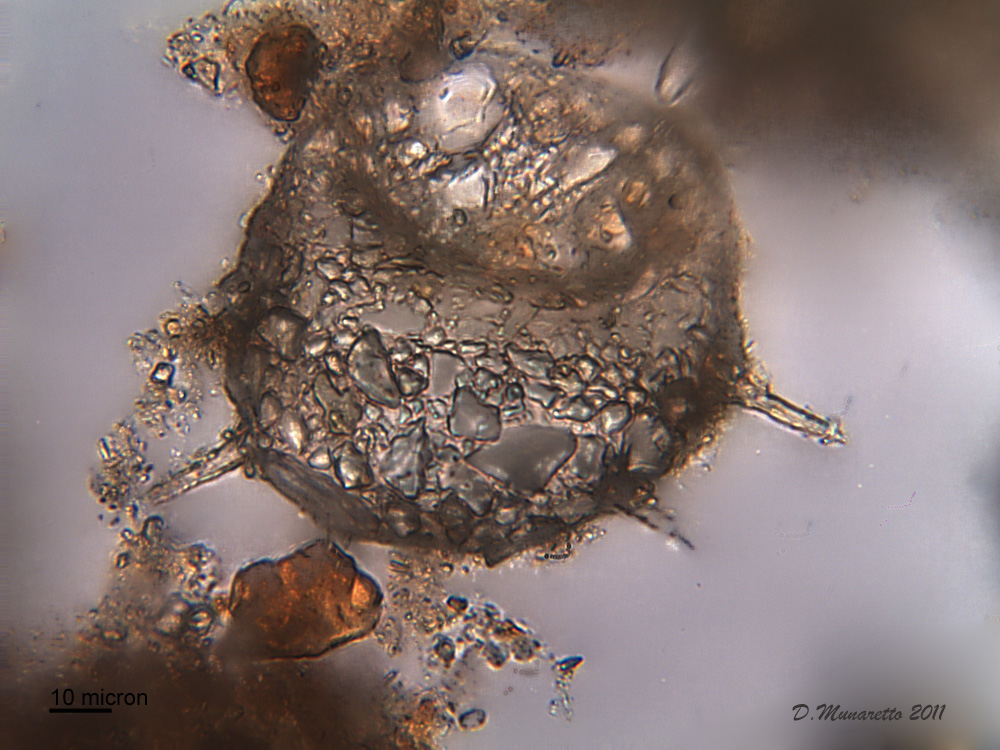 Centropyxis Aculeata